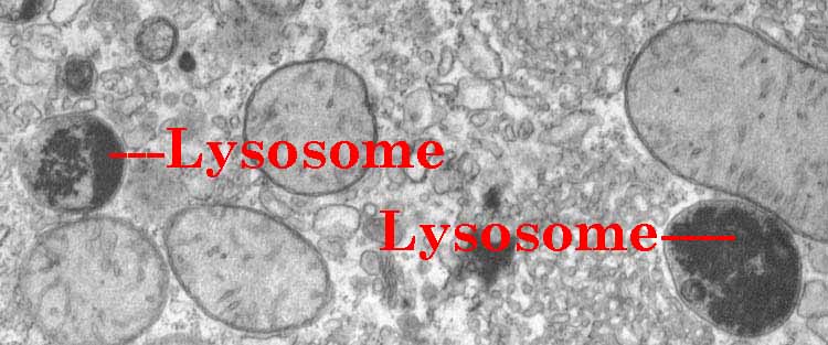 Resultado de imagen de lisosomas microscopio electronico